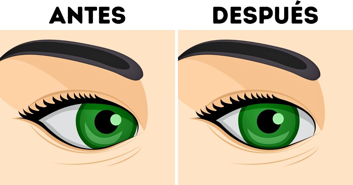 7 Usos del bótox que no tienen relación alguna con la estética