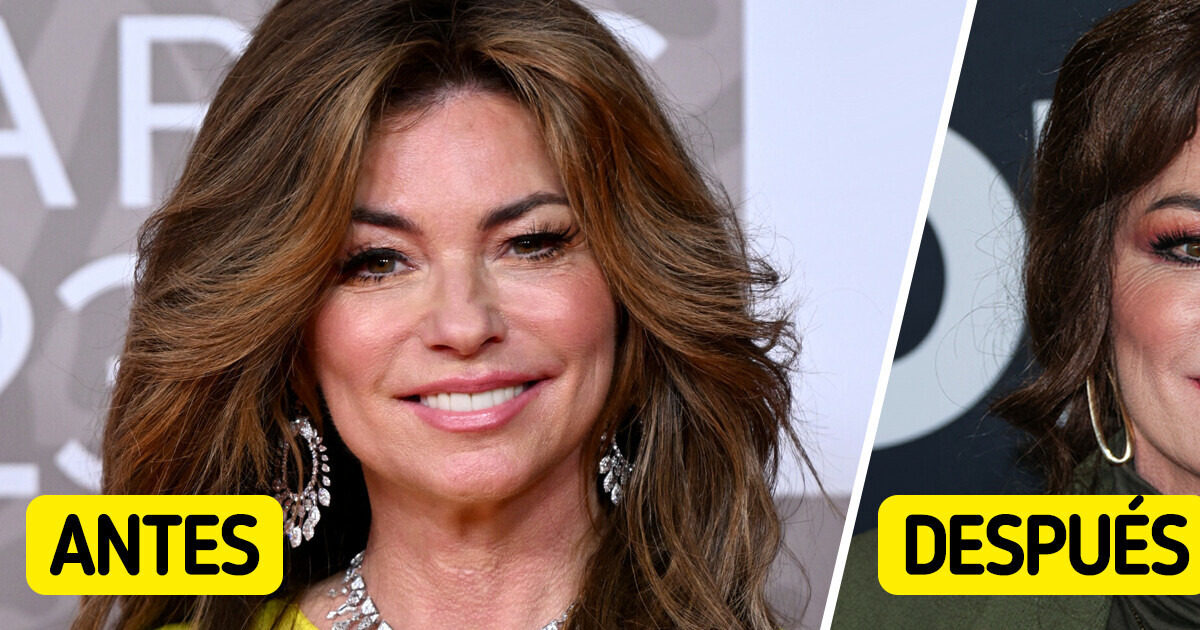 ¿Qué se hizo en la cara? El nuevo look de Shania Twain sorprende a todos