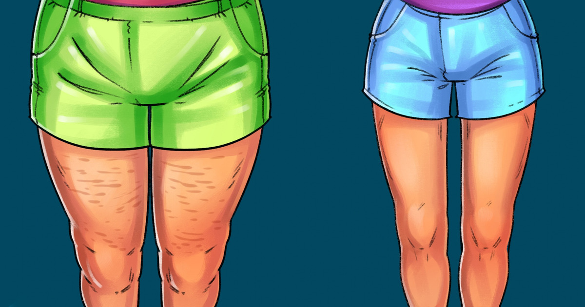 14 Ejercicios sin equipo para conseguir unas piernas perfectas 14 Ejercicios sin equipo para conseguir unas piernas perfectas