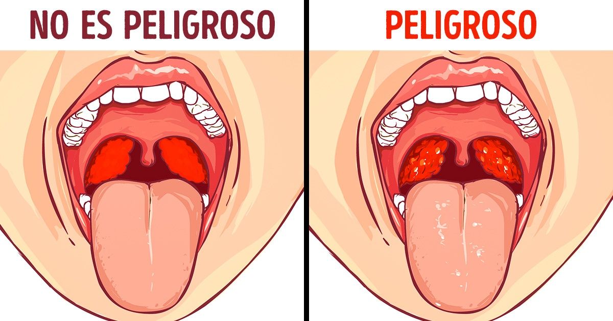 9 Síntomas “peligrosos” que en realidad no son para temer (Spoiler: el dolor en el pecho no es tan simple)