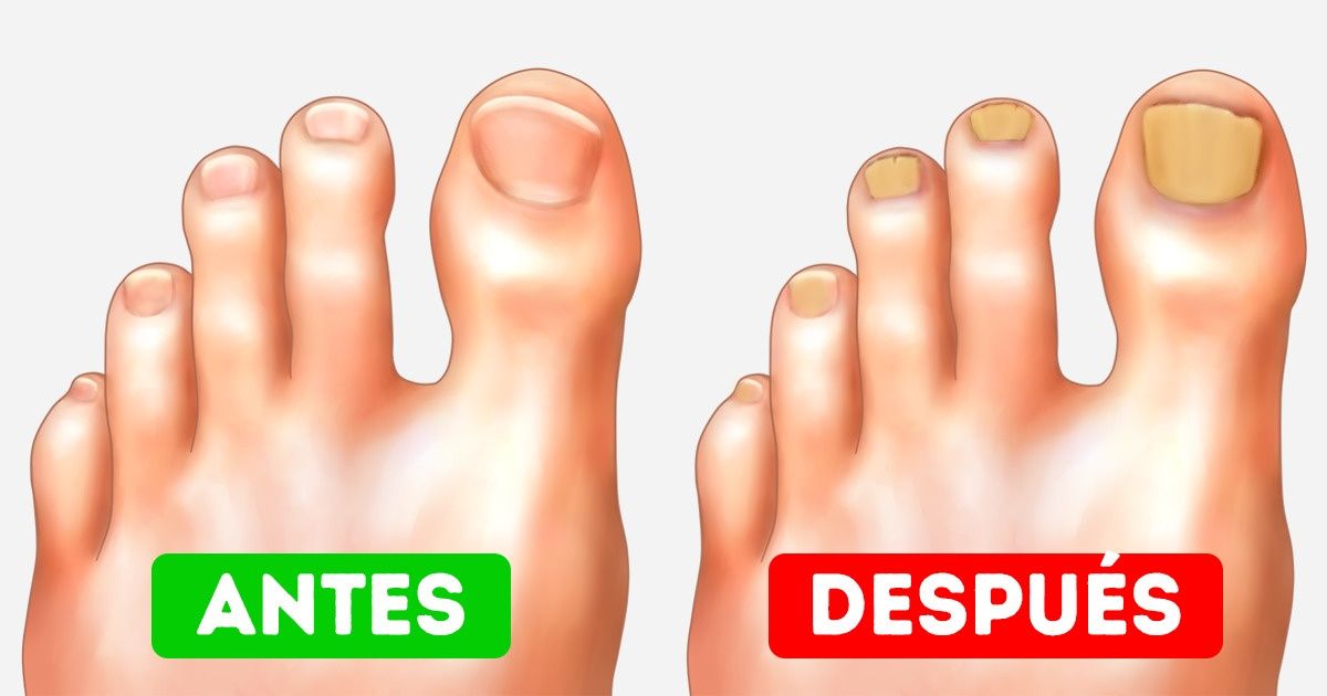 10 Consejos fáciles para hacer que tus pies se vean perfectos