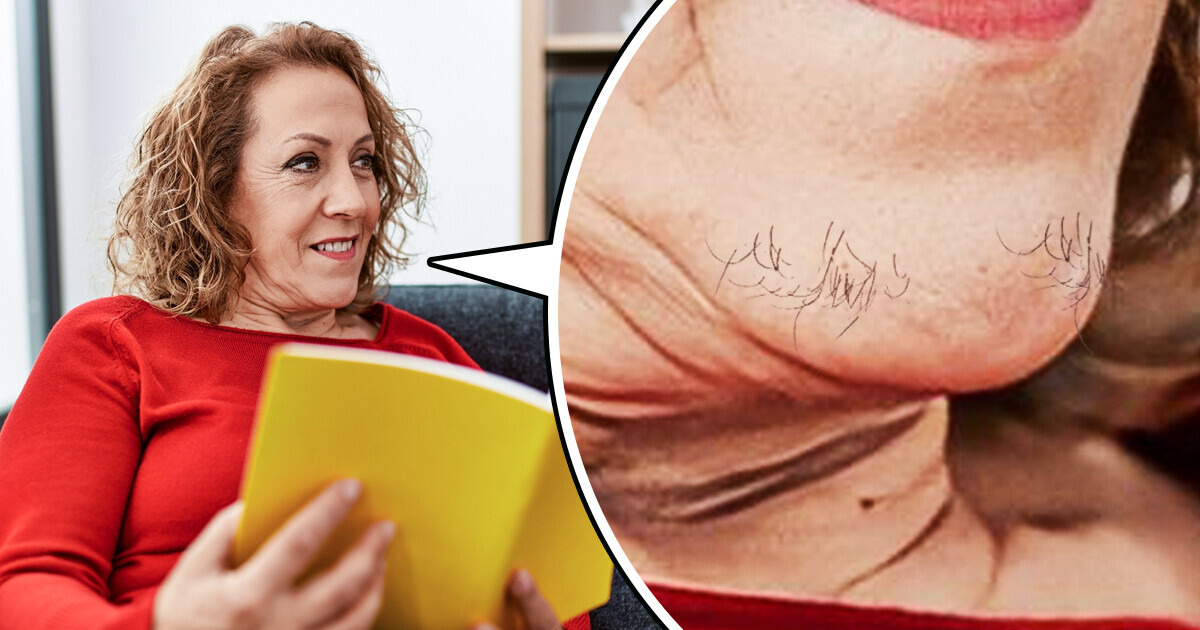 Por qué salen vellos en el mentón cuando la mujer llega a cierta edad Por qué salen vellos en el mentón cuando la mujer llega a cierta edad