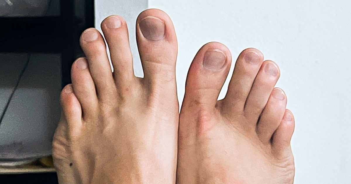 18 Seres que resaltan entre los demás por sus rasgos particulares
