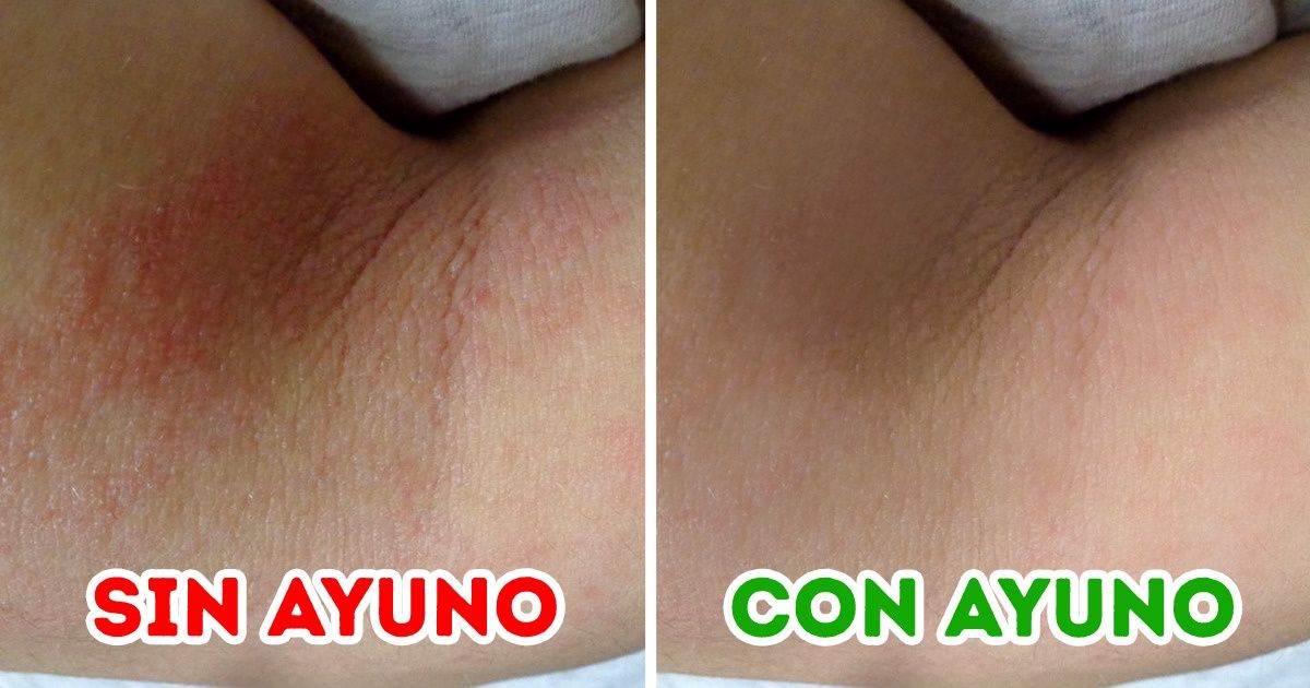 Qué le podría suceder a tu piel si haces ayuno Qué le podría suceder a tu piel si haces ayuno