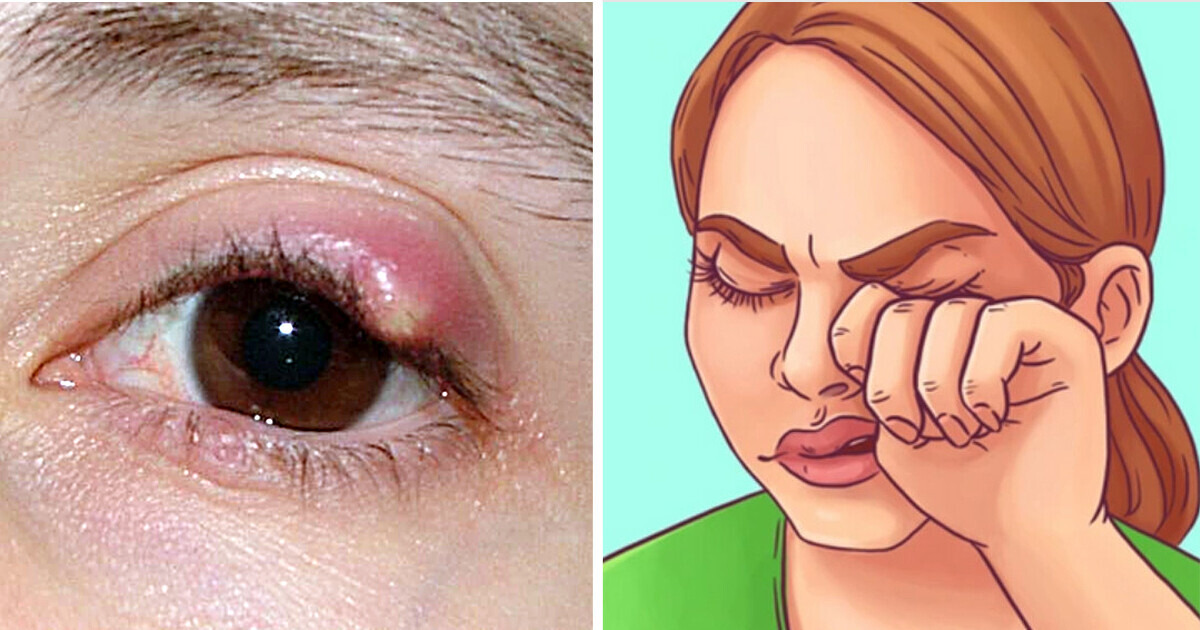 10 Cambios en los ojos que podrían estar avisándote de algo más serio