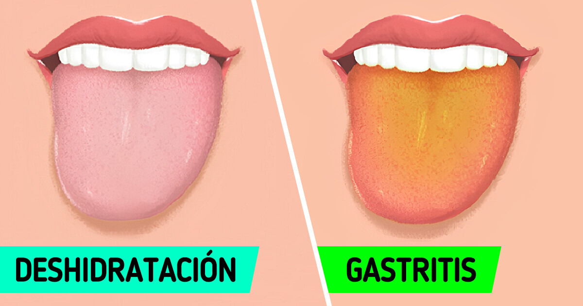 9 Maneras en las que tu lengua puede estar mostrándote que algo anda mal