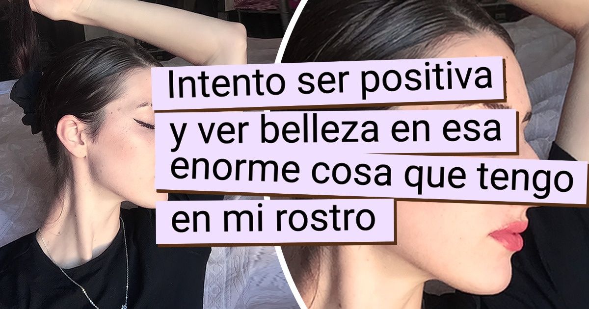 15 Personas que por fin aceptaron su aspecto físico con todas sus peculiaridades 15 Personas que por fin aceptaron su aspecto físico con todas sus peculiaridades