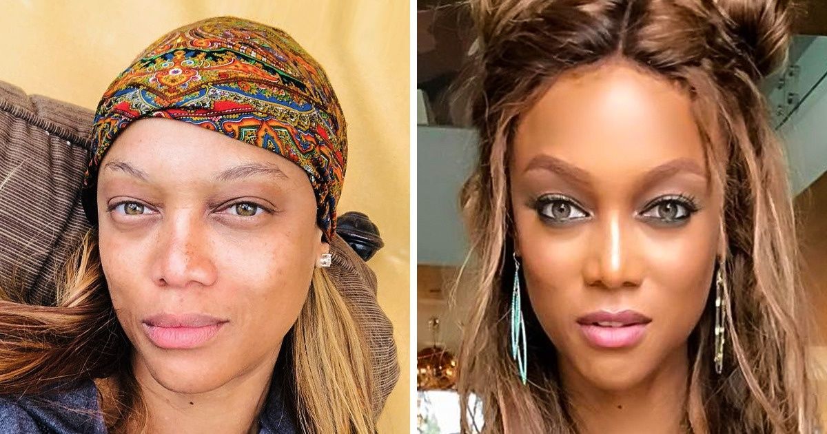 Mujeres famosas que aman sus imperfecciones y ni siquiera tienen en mente someterse a cirugías estéticas Mujeres famosas que aman sus imperfecciones y ni siquiera tienen en mente someterse a cirugías estéticas