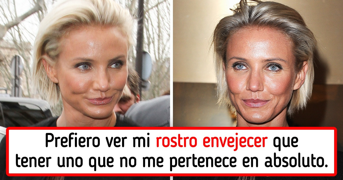 8 Famosas que probaron la cirugía estética una vez y dijeron “nunca más”