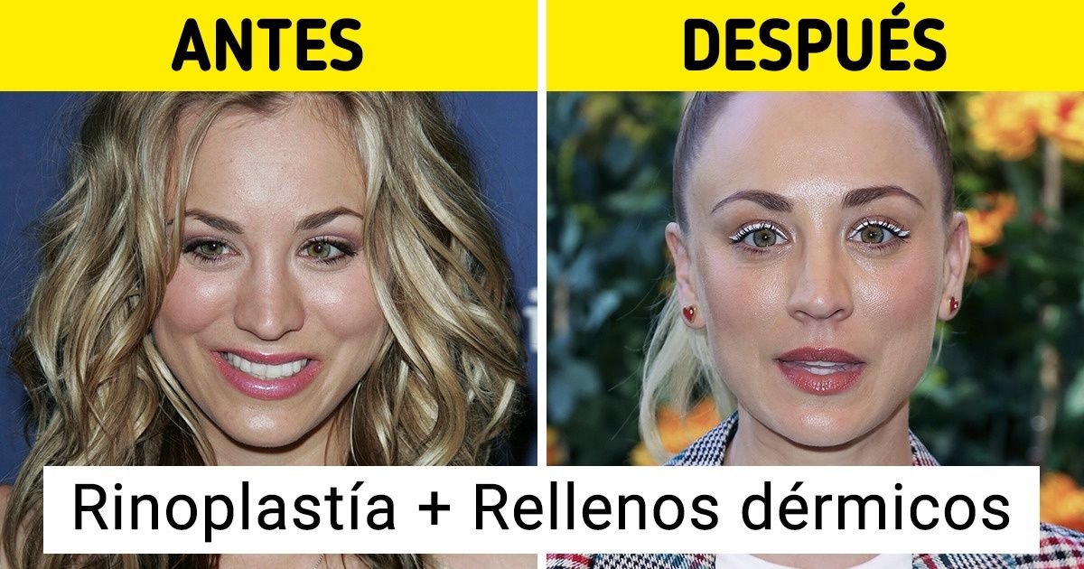17 Famosos que no dudan en recurrir a las cirugías para verse mejor 17 Famosos que no dudan en recurrir a las cirugías para verse mejor