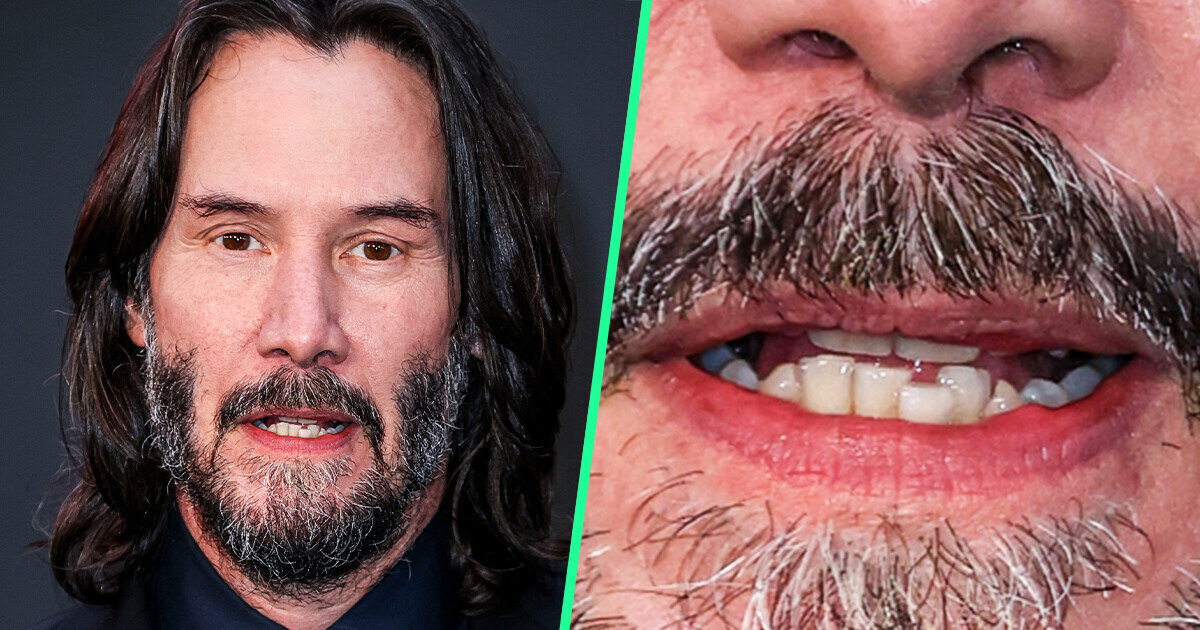 15 Famosos que no tienen problema de enseñar los dientes torcidos