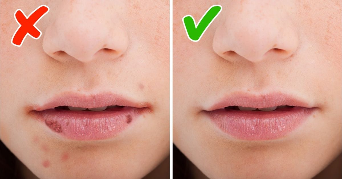 8 Señales que te ayudan a entender qué vitaminas le faltan a tu cuerpo 8 Señales que te ayudan a entender qué vitaminas le faltan a tu cuerpo