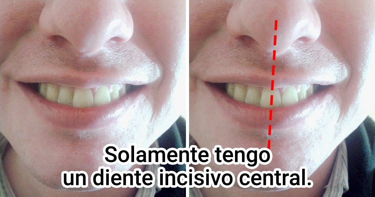15+ Rasgos corporales raros que la naturaleza les obsequió solo a unos pocos