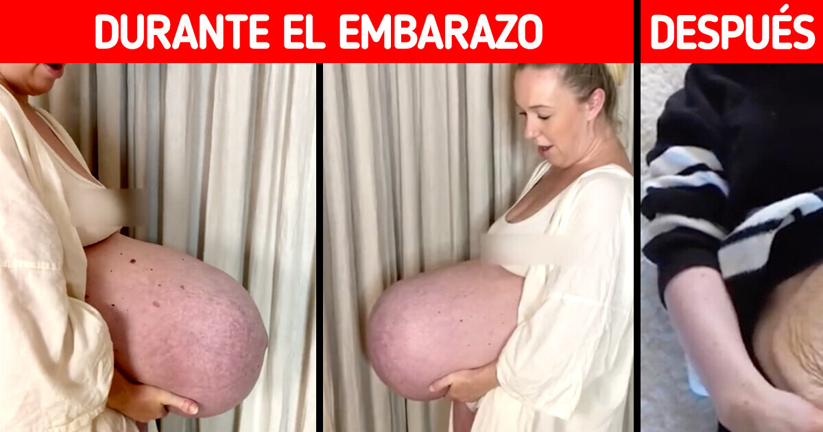 La barriga de una madre embarazada era tan “única” que dejó a la gente literalmente sin palabras