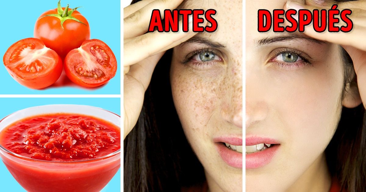 Útiles consejos para deshacerte de las manchas solares en la piel con remedios naturales