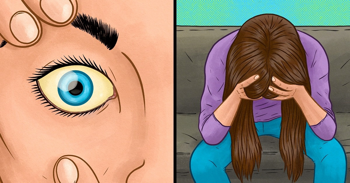 10 Señales que indican deficiencia de vitamina B12 10 Señales que indican deficiencia de vitamina B12