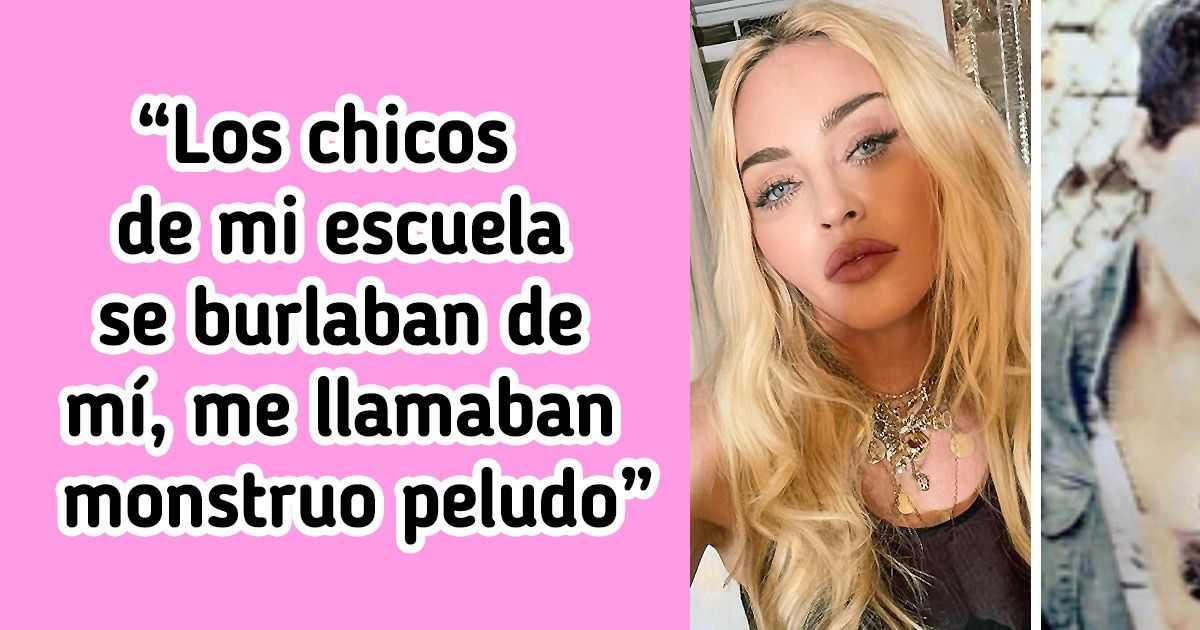 17 Famosos que compartieron cómo sobrellevaron las burlas de sus compañeros en la escuela