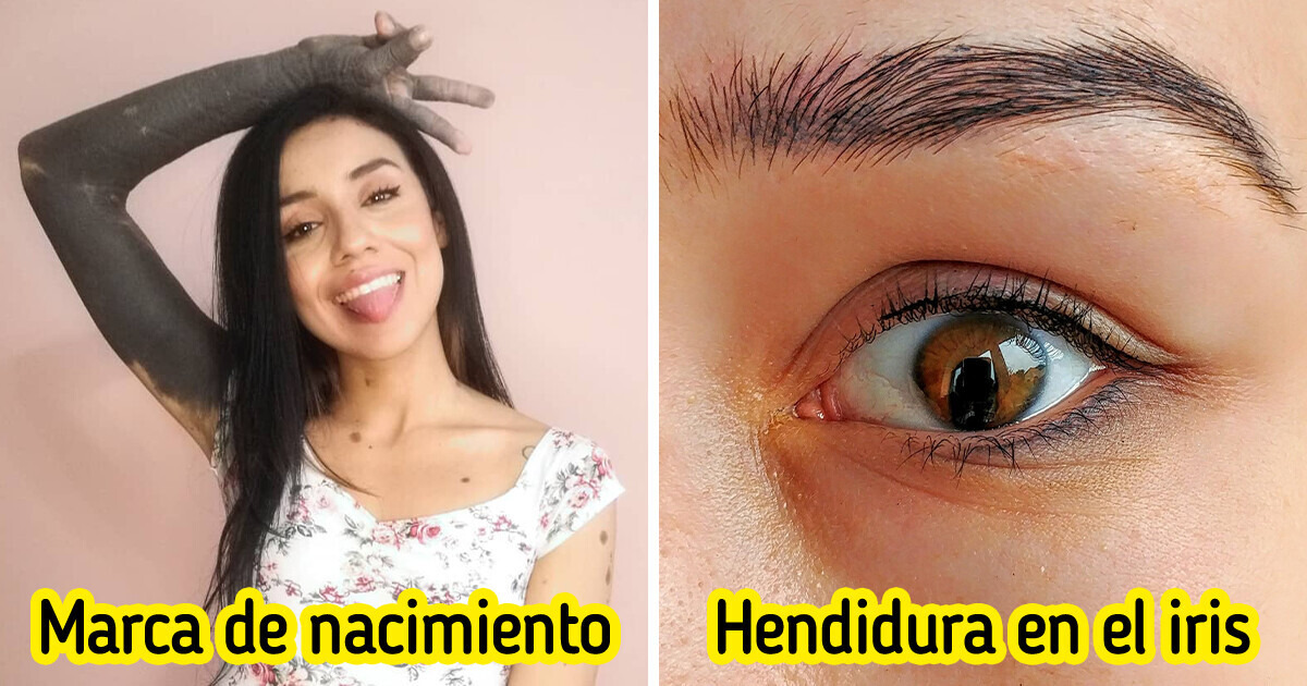 15 Fotos que demuestran que la singularidad es belleza