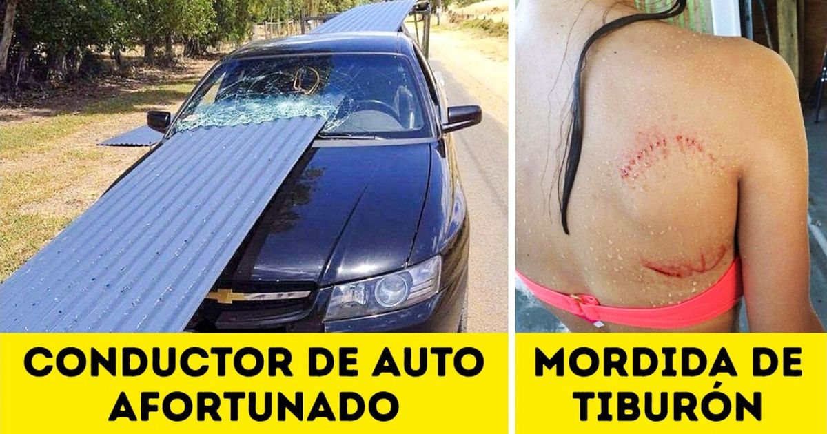 20 Personas que se burlaron de la muerte y sobrevivieron para contarlo