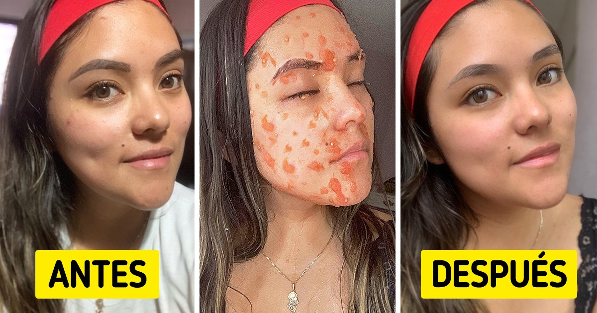 11 Beneficios que puedes obtener del tomate rojo más allá de su simple consumo y que quizá no conocías 11 Beneficios que puedes obtener del tomate rojo más allá de su simple consumo y que quizá no conocías