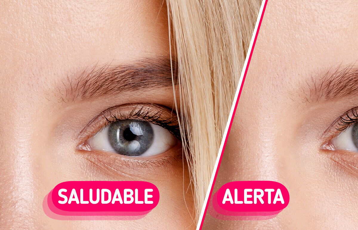 5 Señales en tu rostro que podrían advertir sobre problemas de salud ocultos