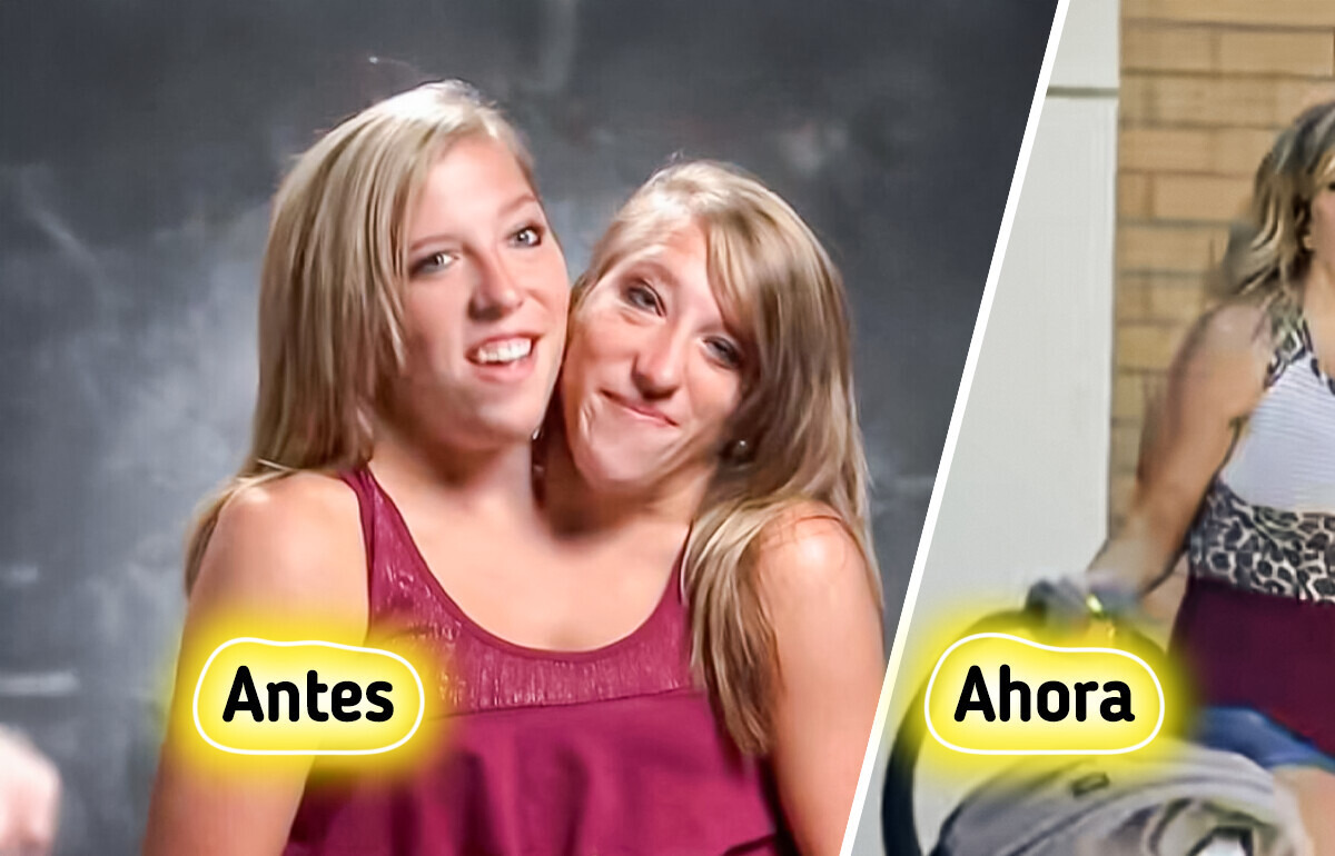 Abby y Brittany: maestras siamesas que transforman su vida en un mensaje de amor