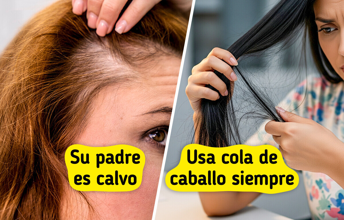 10 Causas cotidianas que están provocando la caída del cabello en mujeres jóvenes 10 Causas cotidianas que están provocando la caída del cabello en mujeres jóvenes