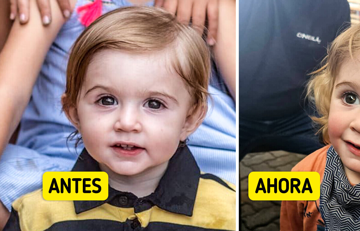 “¡Nunca beses al bebé de nadie!”, una madre advierte a la gente mientras los médicos luchan por salvar el ojo de su hijo