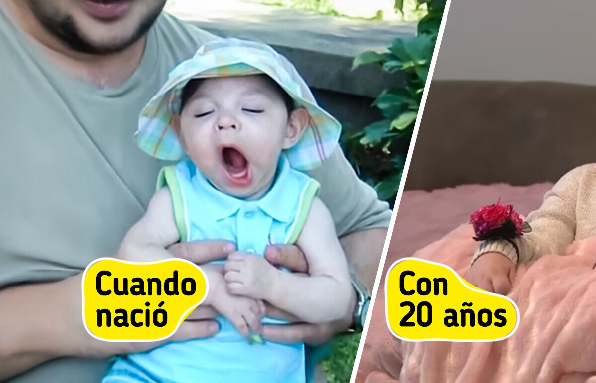 Nació sin cerebro y los médicos no le daban esperanza: hoy celebra 20 años Nació sin cerebro y los médicos no le daban esperanza: hoy celebra 20 años