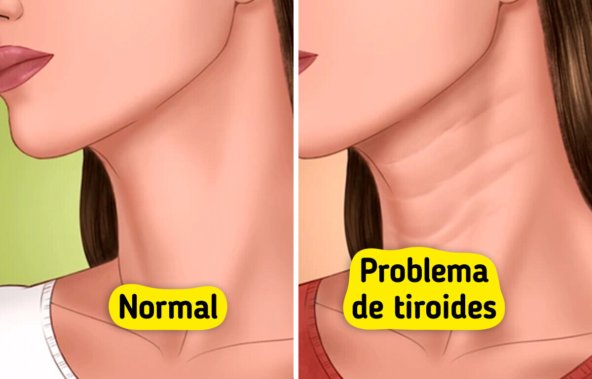 7 Señales silenciosas con las que tu cuerpo te pide ayuda (y casi nadie nota) 7 Señales silenciosas con las que tu cuerpo te pide ayuda (y casi nadie nota)