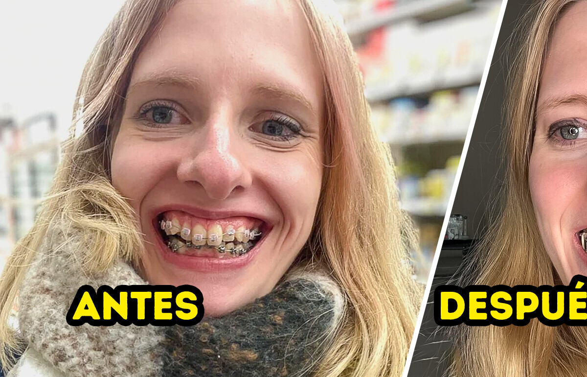 15 Historias que prueban que cuidar tus dientes puede cambiarlo todo
