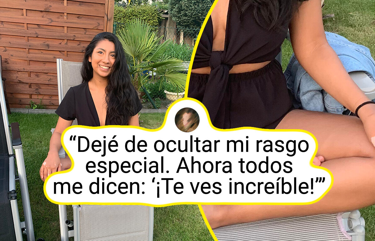 13 Personas con características tan raras que parecen sacadas de un cuento