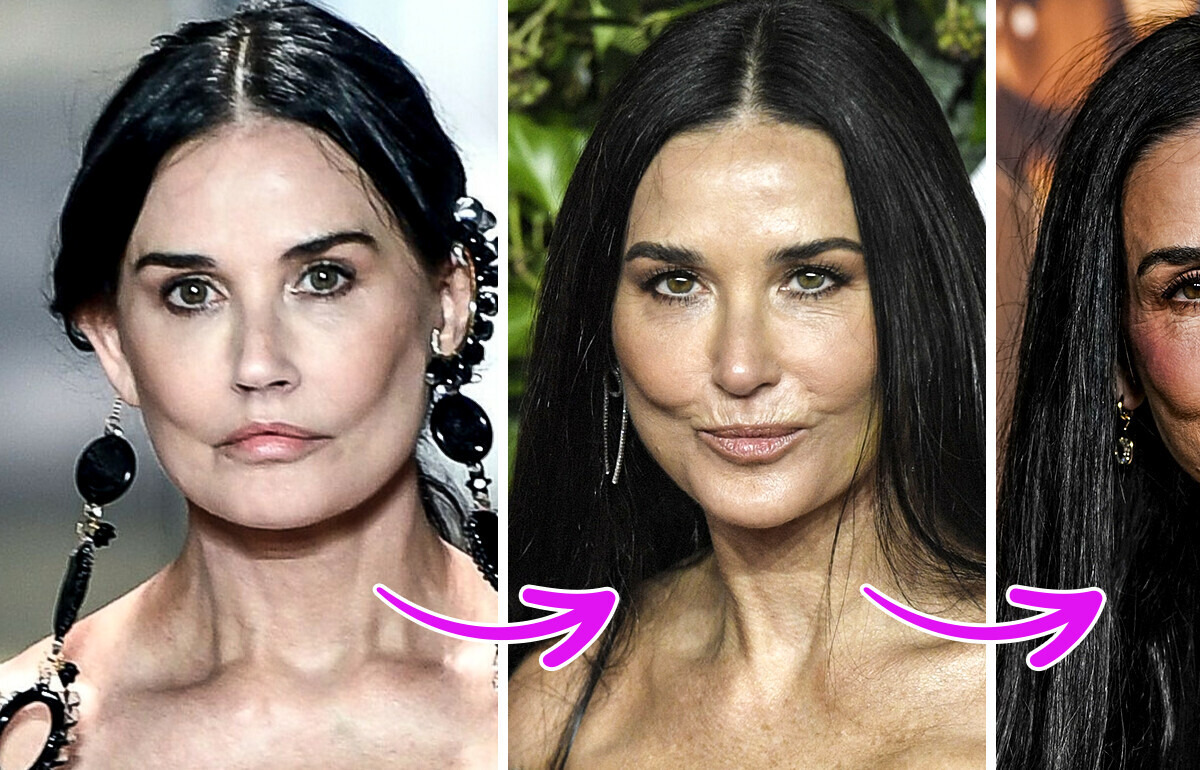 Demi Moore y su impactante transformación facial, esto es lo que dicen los expertos Demi Moore y su impactante transformación facial, esto es lo que dicen los expertos