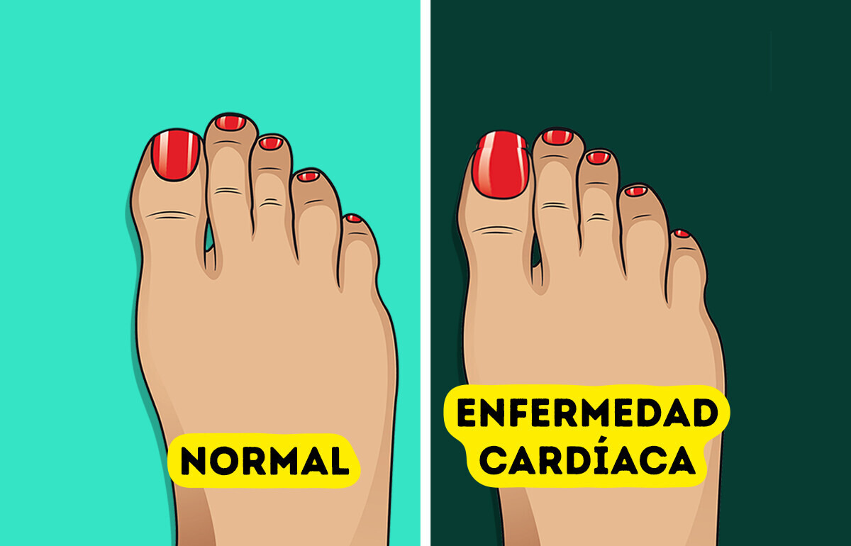 5 Señales de salud que las uñas de tus pies pueden revelar sobre tu cuerpo