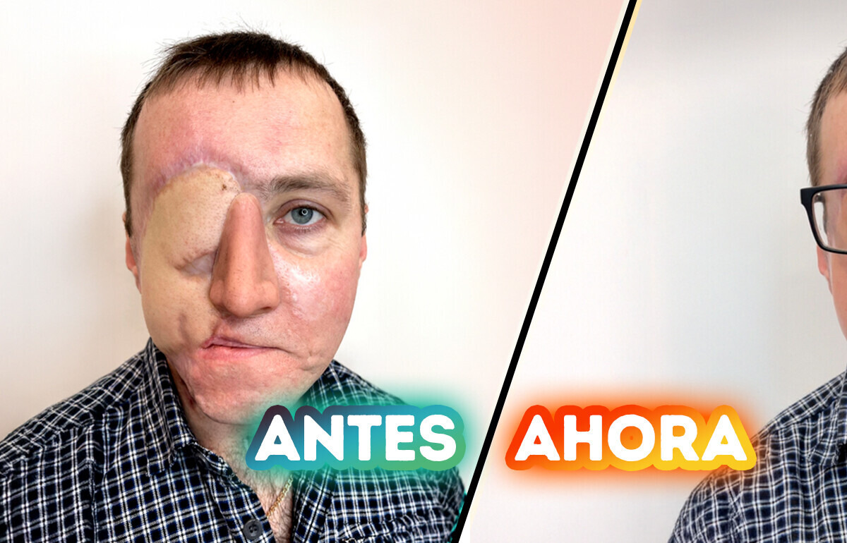 Una artista convierte el dolor en arte con un tatuaje hiperrealista de un ojo para un superviviente de un accidente de tráfico