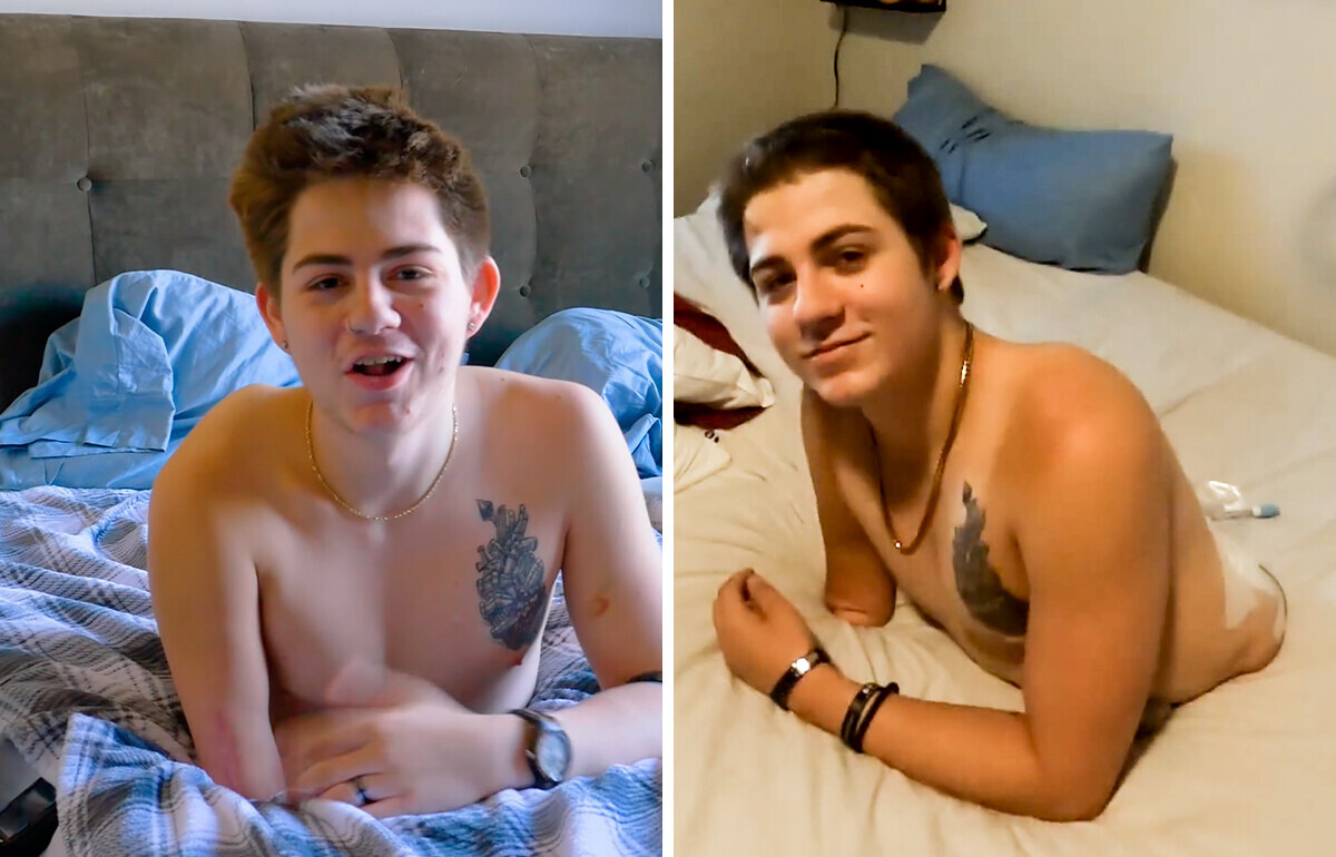 Sobrevive tras perder medio cuerpo y su historia inspira a millones