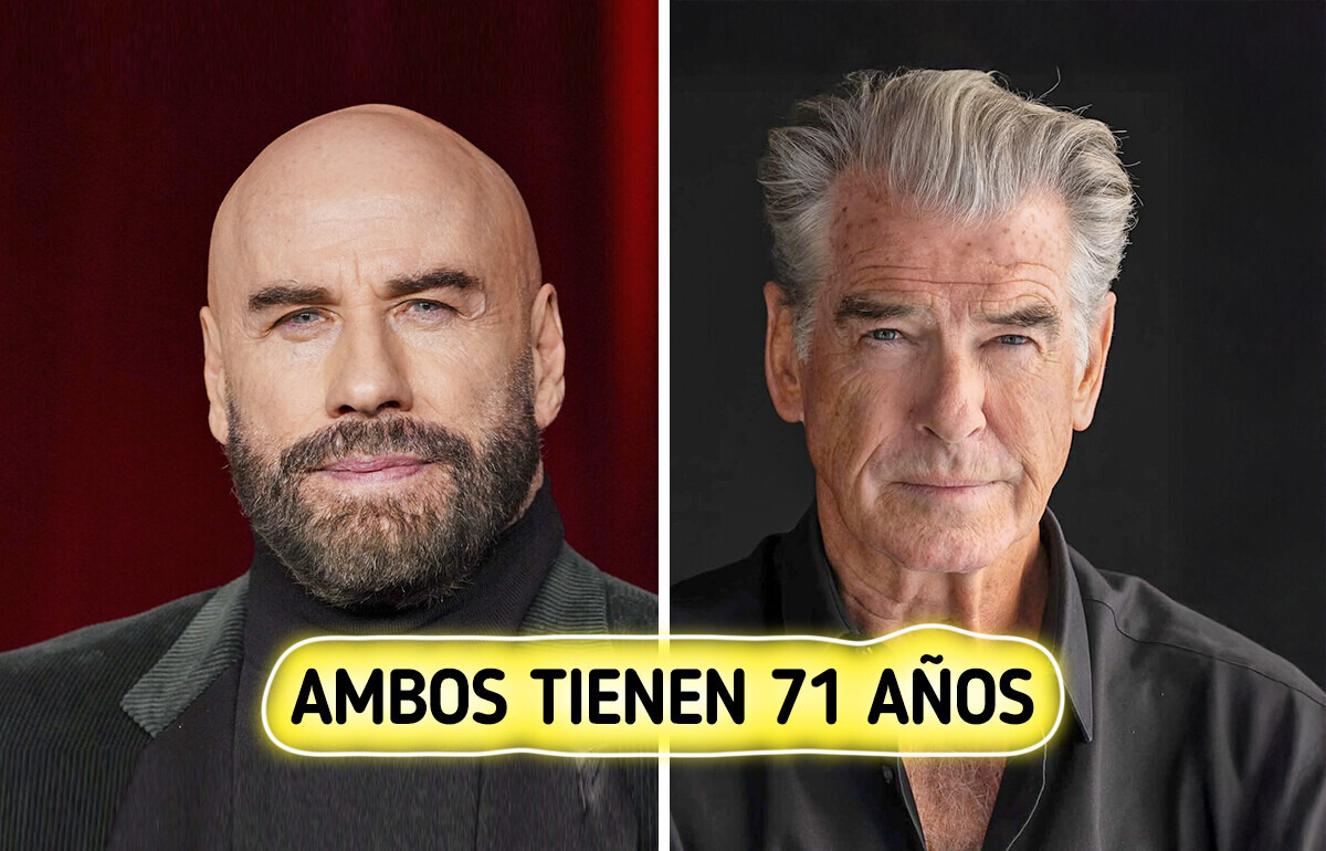 Resultados impactantes de la cirugía plástica en hombres famosos de la misma edad