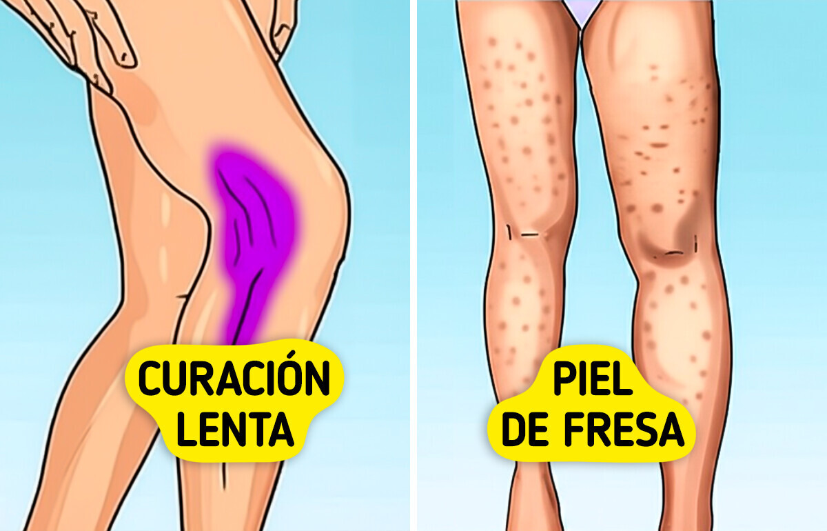 7 Signos de que tu cuerpo puede necesitar más colágeno