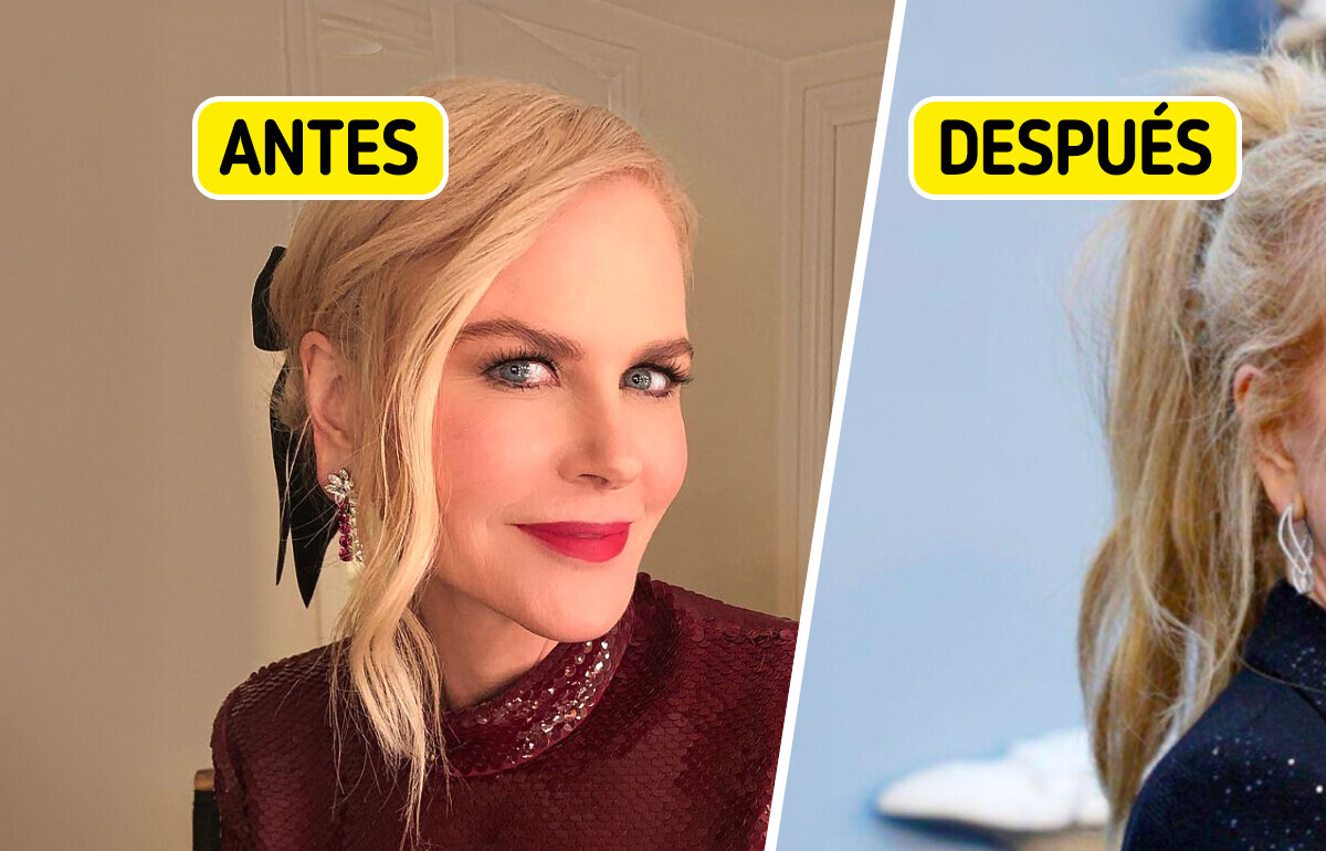“Señales de estiramiento cerca de sus orejas”: Nicole Kidman impacta con su transformación más reciente