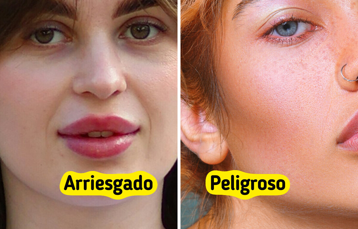10 Tratamientos de belleza que podrían darte más dolores de cabeza que resultados
