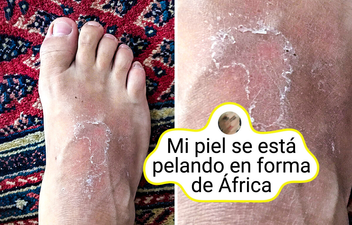 13 Pruebas de que nuestro cuerpo puede tener más trucos que Batman bajo su traje