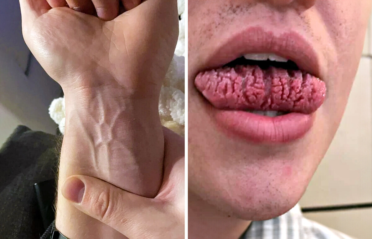 18 Pruebas de que la genética puede sorprendernos de formas increíbles