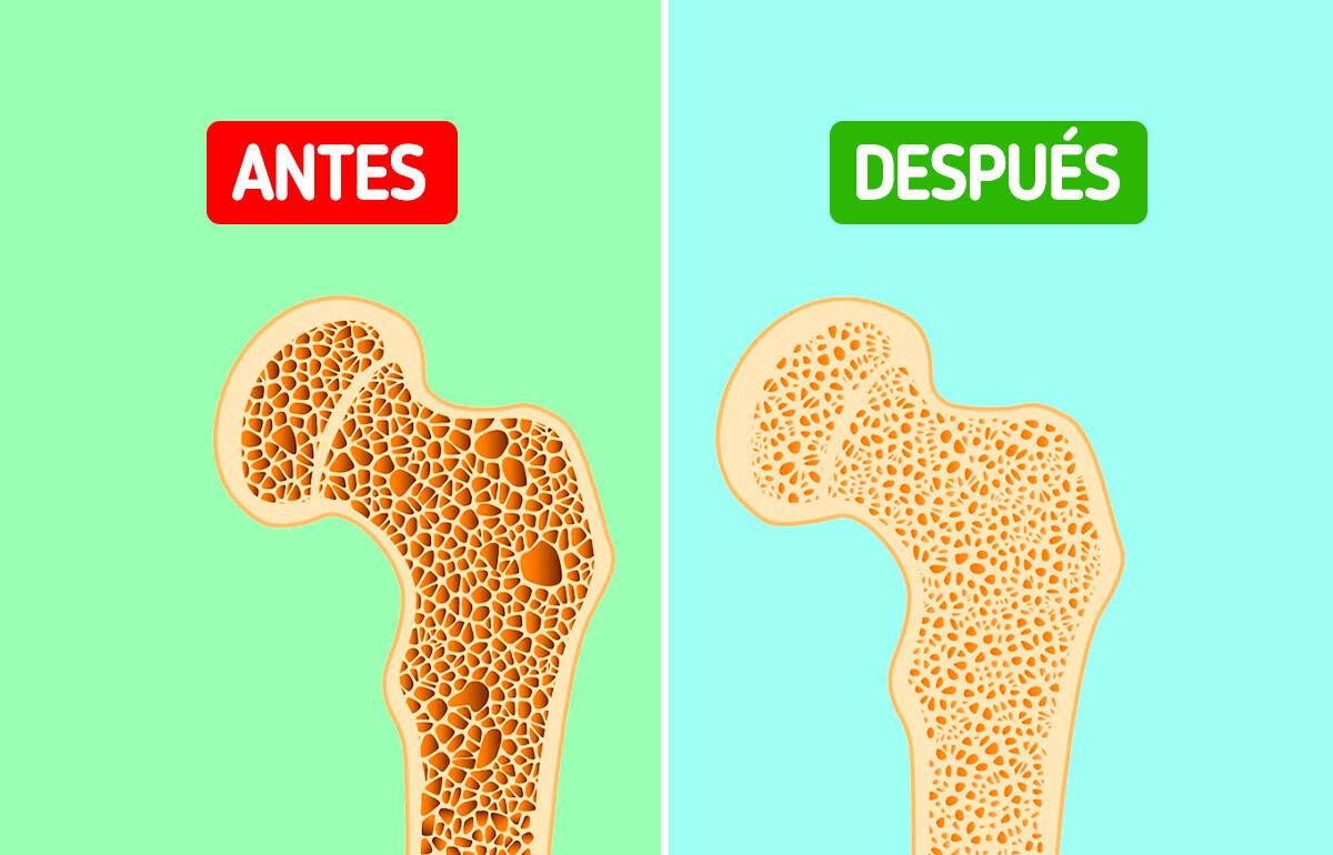 7 Enfermedades que el ejercicio ayuda a controlar (y hasta a prevenir)