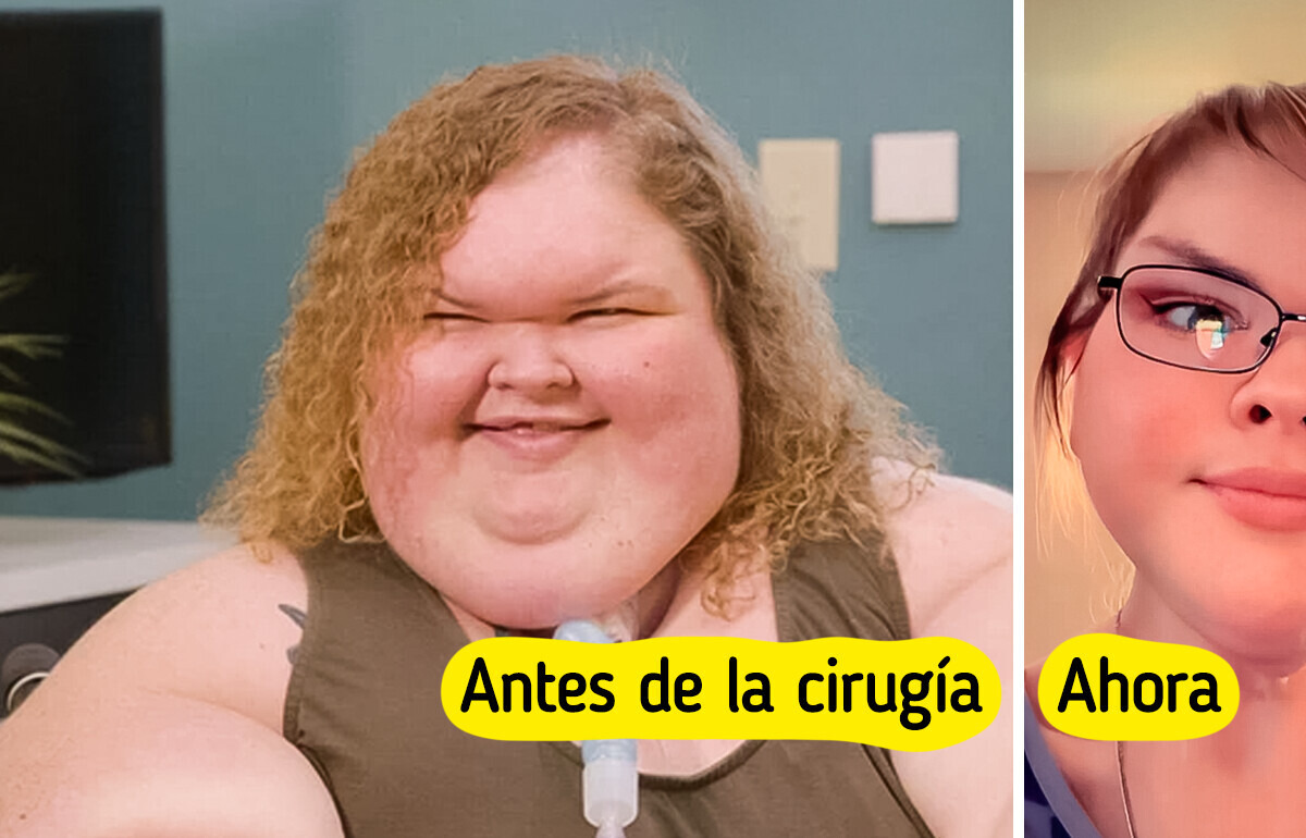 Tammy renace: su emotivo antes y después tras perder 225 kilos y someterse a cirugía Tammy renace: su emotivo antes y después tras perder 225 kilos y someterse a cirugía