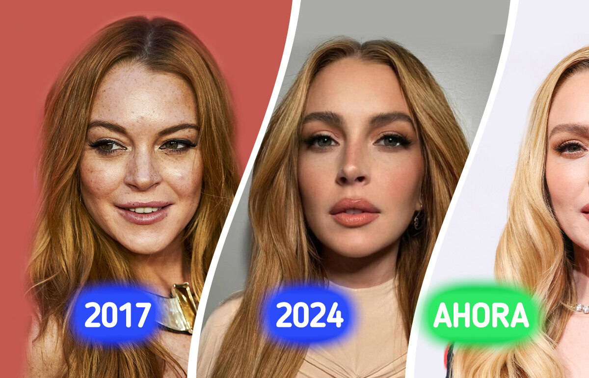 Lindsay Lohan vuelve a conmocionar con su nuevo look y un cirujano plástico revela lo que podría haberse hecho Lindsay Lohan vuelve a conmocionar con su nuevo look y un cirujano plástico revela lo que podría haberse hecho