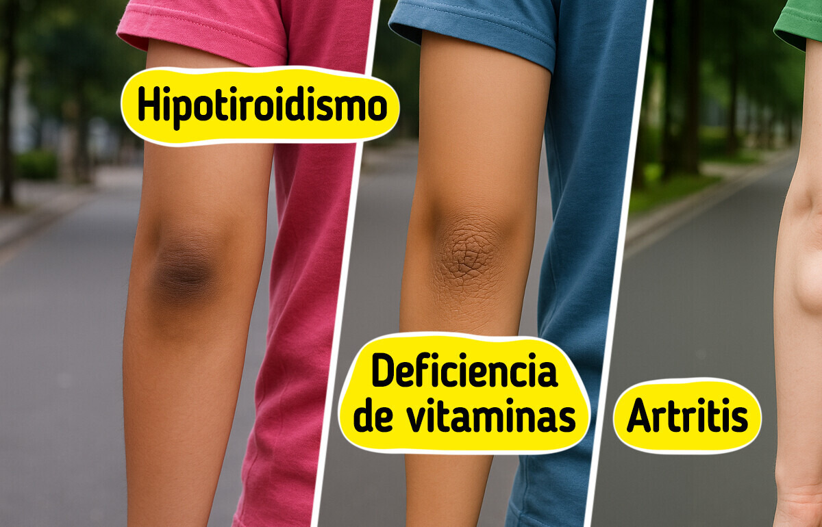 10 Cambios en tus codos que podrían ser un aviso de tu cuerpo 10 Cambios en tus codos que podrían ser un aviso de tu cuerpo