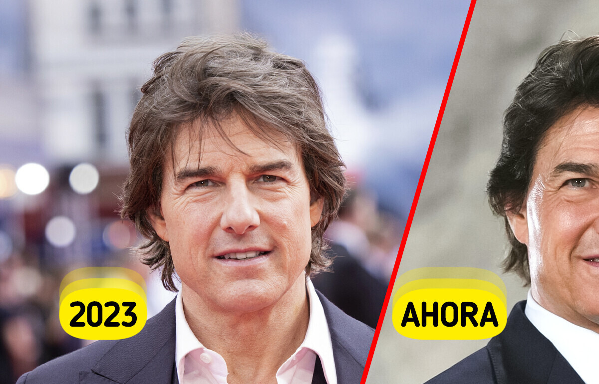 ¿Qué le pasó a la cara de Tom Cruise? Esto es lo que dicen los especialistas
