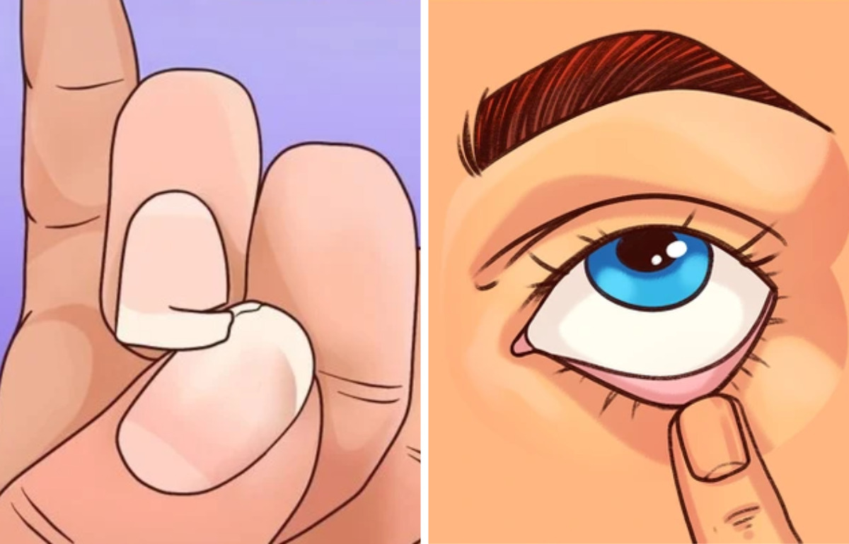 10+ Formas en que el cuerpo avisa que podría tener deficiencia de hierro