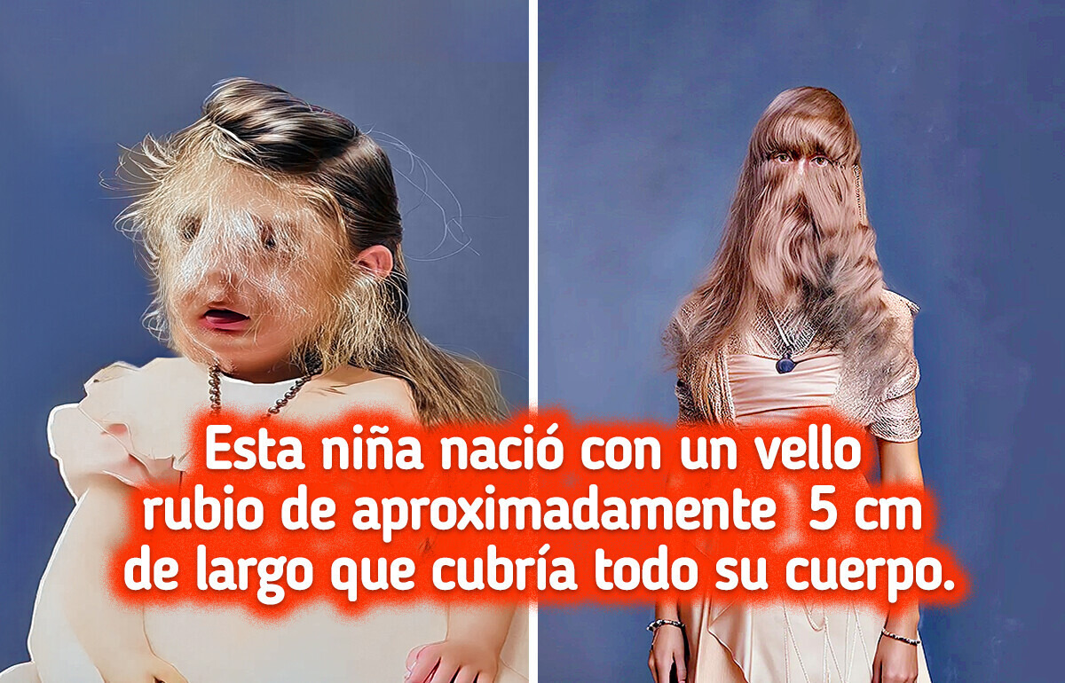 15 Imágenes que nos recuerdan lo asombroso y único que puede ser el cuerpo humano 15 Imágenes que nos recuerdan lo asombroso y único que puede ser el cuerpo humano