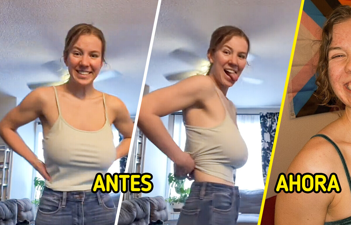 Mujer documenta su reducción de senos: impresionante antes y después